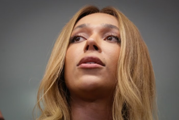 Deputada Erika Hilton teve reembolso de R$ 24,7 mil por cirurgia no nariz, ou seja, fez plástica com dinheiro do povo